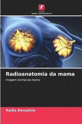 Radioanatomia da mama 1