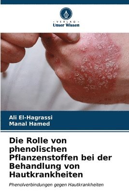 Die Rolle von phenolischen Pflanzenstoffen bei der Behandlung von Hautkrankheiten 1