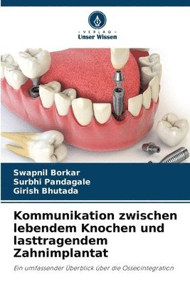 Kommunikation zwischen lebendem Knochen und lasttragendem Zahnimplantat 1