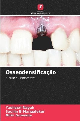 Osseodensificao 1