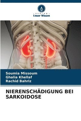 Nierenschdigung Bei Sarkoidose 1