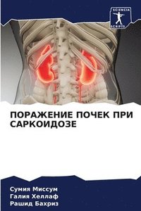 bokomslag &#1055;&#1054;&#1056;&#1040;&#1046;&#1045;&#1053;&#1048;&#1045; &#1055;&#1054;&#1063;&#1045;&#1050; &#1055;&#1056;&#1048; &#1057;&#1040;&#1056;&#1050;&#1054;&#1048;&#1044;&#1054;&#1047;&#1045;