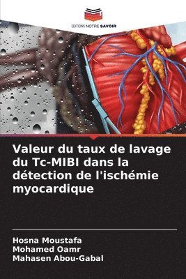 bokomslag Valeur du taux de lavage du Tc-MIBI dans la dtection de l'ischmie myocardique