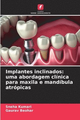 bokomslag Implantes inclinados