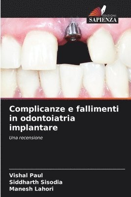 Complicanze e fallimenti in odontoiatria implantare 1