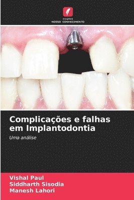 Complicaes e falhas em Implantodontia 1