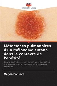 bokomslag Mtastases pulmonaires d'un mlanome cutan dans le contexte de l'obsit