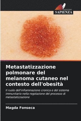 Metastatizzazione polmonare del melanoma cutaneo nel contesto dell'obesit 1