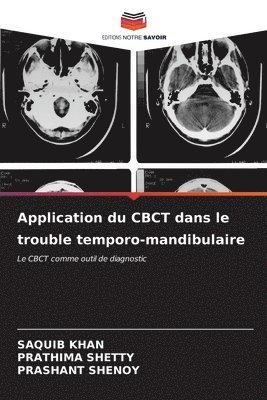Application du CBCT dans le trouble temporo-mandibulaire 1