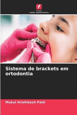 Sistema de brackets em ortodontia 1