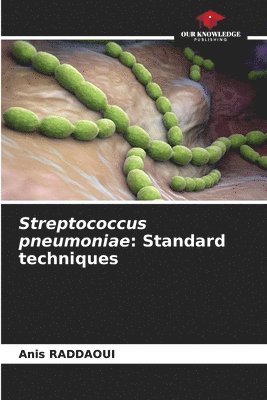 Streptococcus pneumoniae 1
