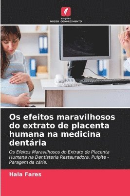 Os efeitos maravilhosos do extrato de placenta humana na medicina dentria 1