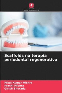 bokomslag Scaffolds na terapia periodontal regenerativa