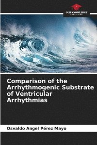 bokomslag Comparison of the Arrhythmogenic Substrate of Ventricular Arrhythmias