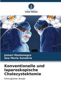 bokomslag Konventionelle und laparoskopische Cholezystektomie