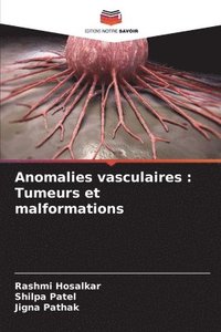 bokomslag Anomalies vasculaires
