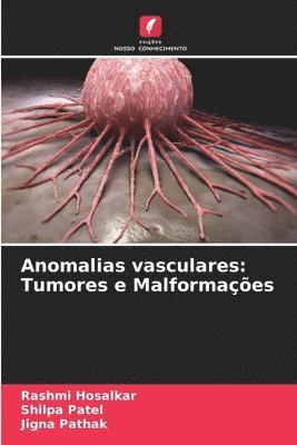 Anomalias vasculares 1