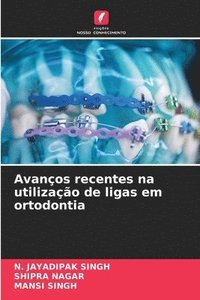 bokomslag Avanos recentes na utilizao de ligas em ortodontia