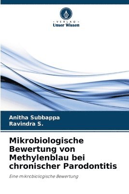 Mikrobiologische Bewertung von Methylenblau bei chronischer Parodontitis 1