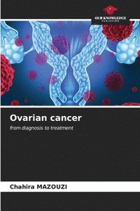 bokomslag Ovarian cancer