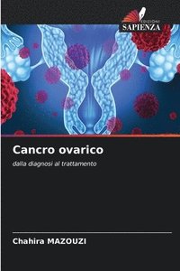 bokomslag Cancro ovarico