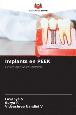 Implants en PEEK 1