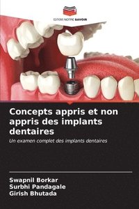 bokomslag Concepts appris et non appris des implants dentaires