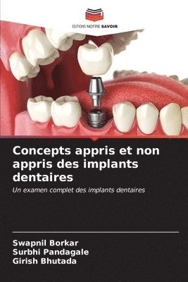 Concepts appris et non appris des implants dentaires 1