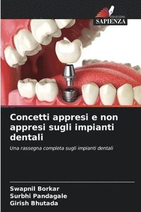 bokomslag Concetti appresi e non appresi sugli impianti dentali