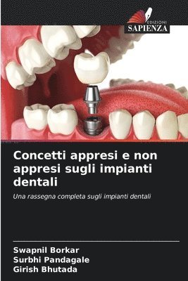 Concetti appresi e non appresi sugli impianti dentali 1
