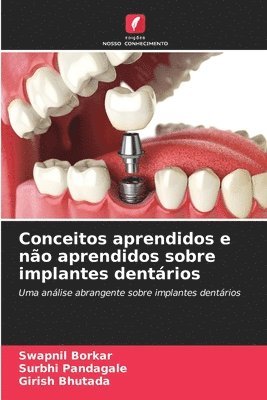 Conceitos aprendidos e no aprendidos sobre implantes dentrios 1