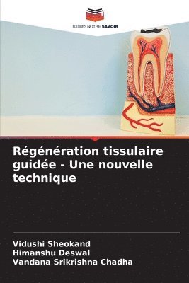 Rgnration tissulaire guide - Une nouvelle technique 1