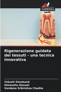 bokomslag Rigenerazione guidata dei tessuti - una tecnica innovativa