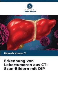 bokomslag Erkennung von Lebertumoren aus CT-Scan-Bildern mit DIP