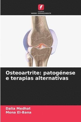 Osteoartrite 1