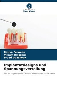 bokomslag Implantatdesigns und Spannungsverteilung
