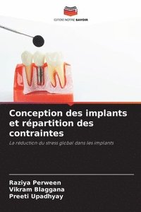 bokomslag Conception des implants et rpartition des contraintes