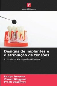 bokomslag Designs de implantes e distribuio de tenses