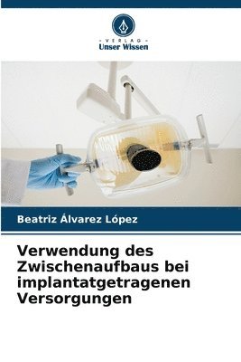 Verwendung des Zwischenaufbaus bei implantatgetragenen Versorgungen 1