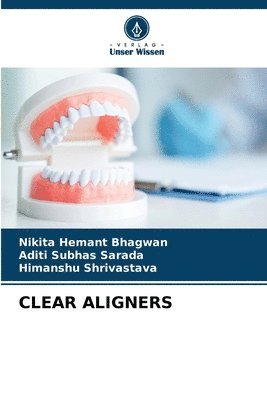 Clear Aligners 1
