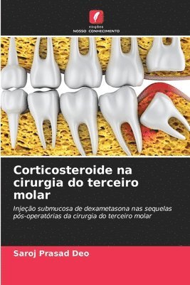 Corticosteroide na cirurgia do terceiro molar 1