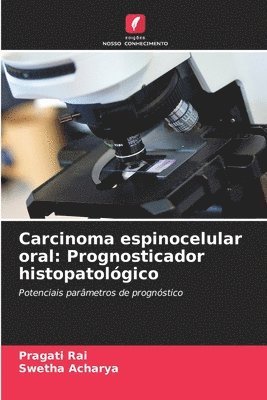 Carcinoma espinocelular oral 1