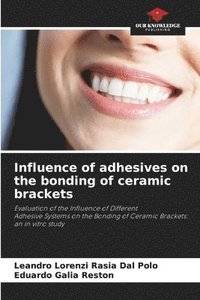 bokomslag Influence of adhesives on the bonding of ceramic brackets