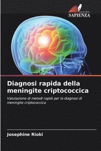 bokomslag Diagnosi rapida della meningite criptococcica