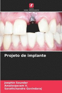 bokomslag Projeto de implante