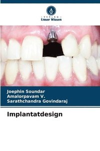bokomslag Implantatdesign