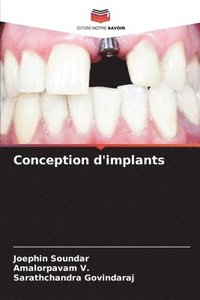 bokomslag Conception d'implants