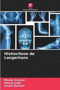 bokomslag Histiocitose de Langerhans