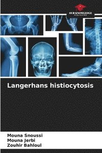 bokomslag Langerhans histiocytosis