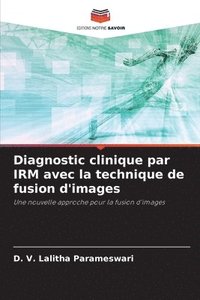 bokomslag Diagnostic clinique par IRM avec la technique de fusion d'images